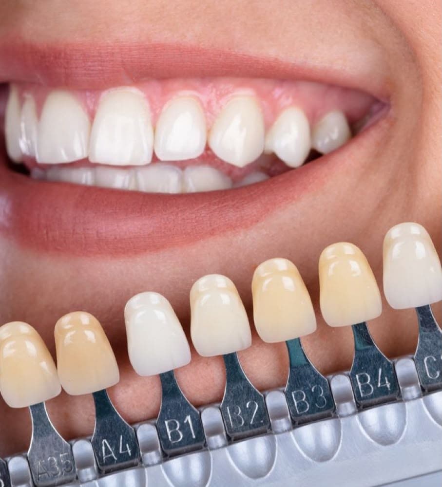 Cosmetic Dentistry