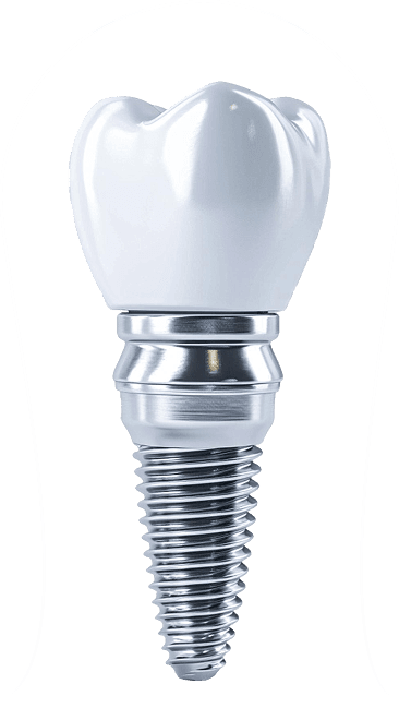 Dental Implant structure